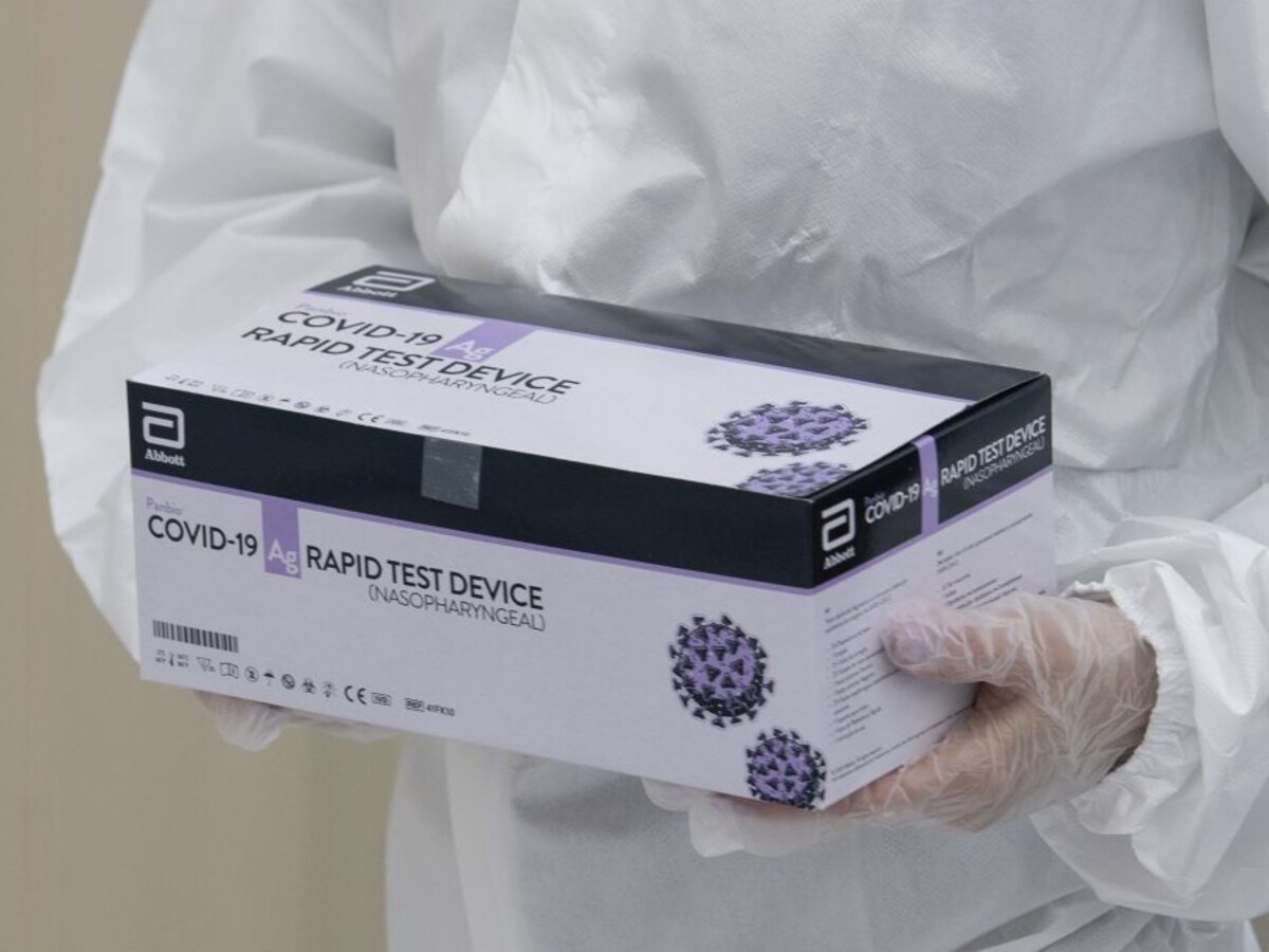 Negatívny test môže znamenať aj inkubačnú dobu, varuje MZ SR