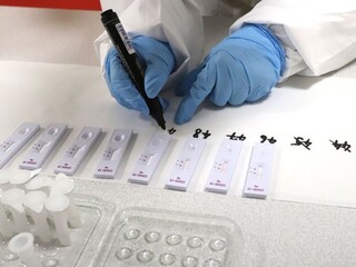 Testovanie v automobilke dopadlo dobre, nakazených bolo menej