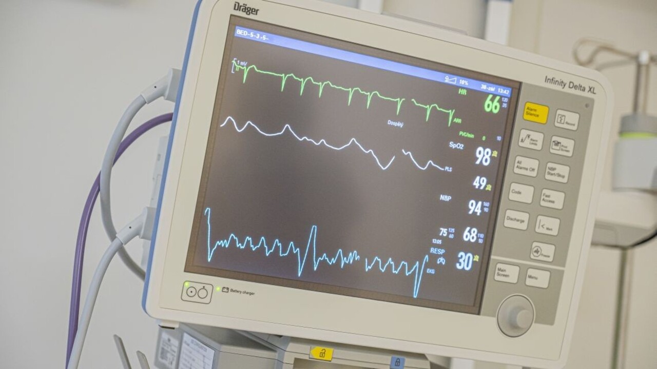 Otvorili nové Detské kardiocentrum, je jedným z najprogresívnejších v Európe