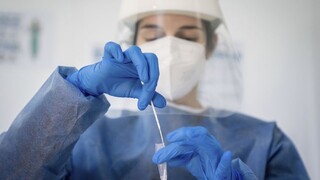 Na Slovensku potvrdili kolumbijský variant koronavírusu