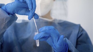 Koronavírus unikol z laboratória, verí bývalý šéf Centra pre kontrolu a prevenciu