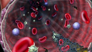 Vedci objavili látky v krvi, podľa ktorých sa dá predvídať priebeh koronavírusu
