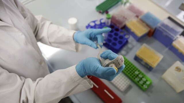 vedec, laboratórium, test, 1140x