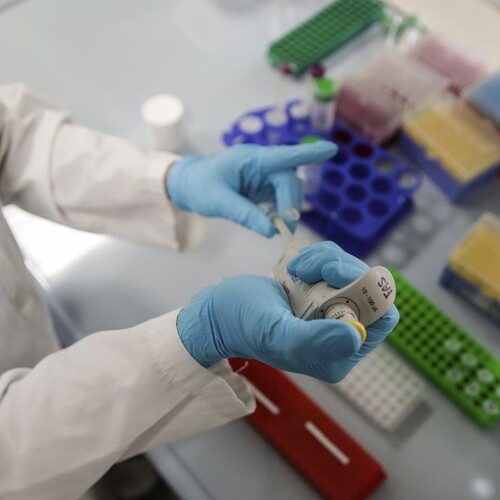 vedec, laboratórium, test, 1140x
