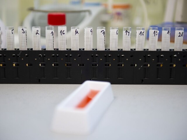V Košiciach skúmajú premorenosť, test na protilátky je zadarmo