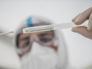 PCR test 1140 px