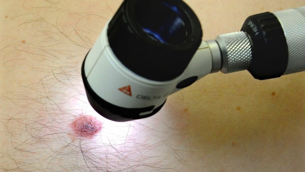 Takmer 90 percentám prípadov rakoviny kože sa dá predísť. Potrebná je včasná diagnostika
