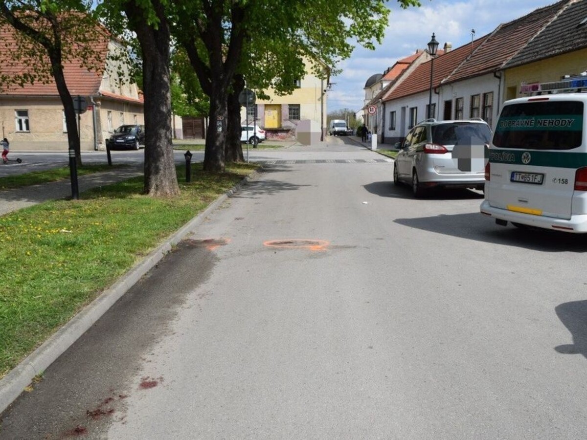 Tragická nehoda. Žena po páde z bicykla zraneniam podľahla
