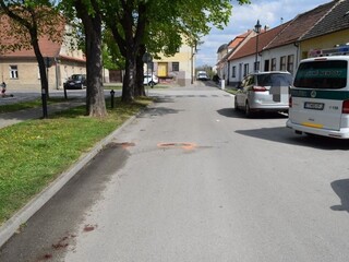 Tragická nehoda. Žena po páde z bicykla zraneniam podľahla