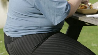 obezita nadváha tučnota 1140 px