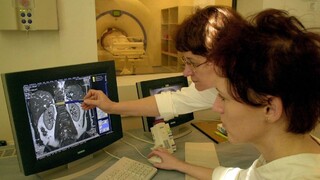 Skríningy sa opäť obnovia, Lengvarský sa vyjadril aj k lieku na liečbu rakoviny