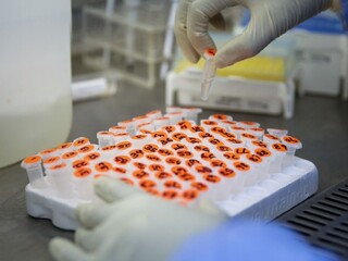 Čína odmieta tvrdenia o výskyte ochorenia v laboratóriu vo Wu-chane v roku 2019