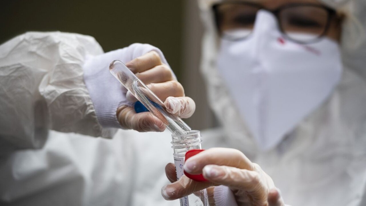 V prípade hromadných podujatí sa bude možné preukázať aj LAMP testom