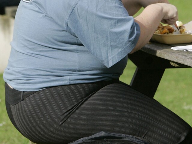 Obezita zrejme urýchľuje starnutie mozgu, naznačuje medzinárodná štúdia