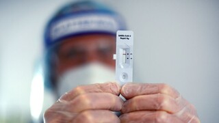 Ambulancie dostanú antigénové testy, preveria pacientov aj zamestnancov