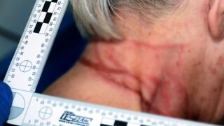 Žena škrtila káblom svoju matku, zachránila sa skokom z balkóna