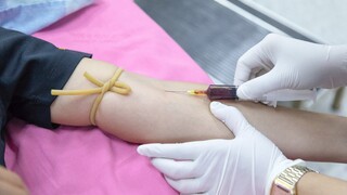 Darovanie krvi je bezpečné, ak neurobíte túto vec