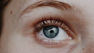 Zatočte s kruhmi pod očami. Bežne dostupná bylinka vyrieši vačky aj tmavú farbu