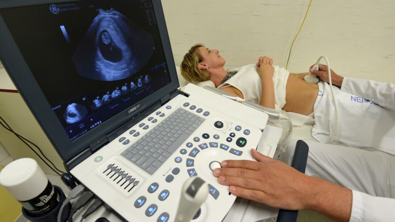 Novinka pre rodičov v očakávaní. V českej nemocnici im vytlačia 3D model dieťaťa