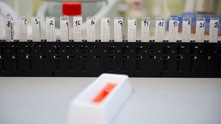 Vo Francúzsku sa objavil nový variant koronavírusu, testy ho odhalili u 12 osôb