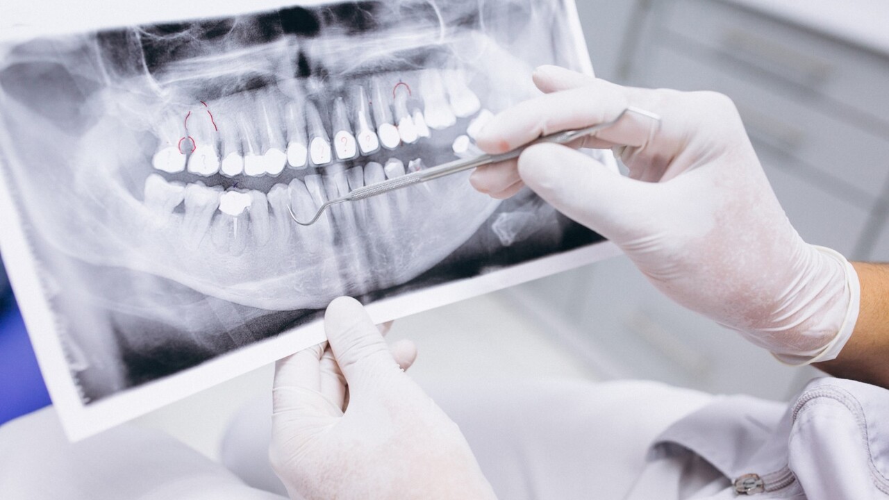 Veľká chyba, ktorej sa dopúšťate pri čistení zubnou niťou