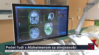 Počet ľudí s Alzheimerom výrazne stúpa. Netýka sa len starých, upozorňujú odborníci