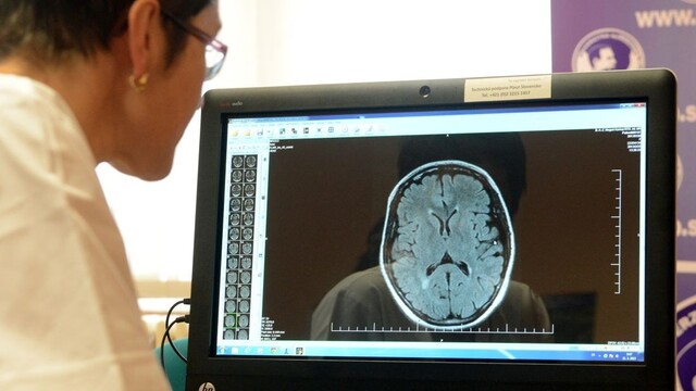 Neurologička o tetánii: Pri záchvate môžu vzniknúť bolestivé kŕče a strach zo smrti