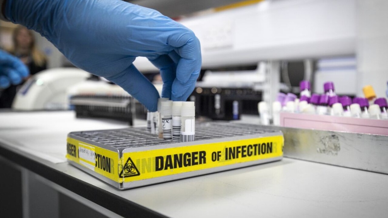 Objavili sa prípady, keď sa človek nakazil covidom aj chrípkou. Je flurona nebezpečná?