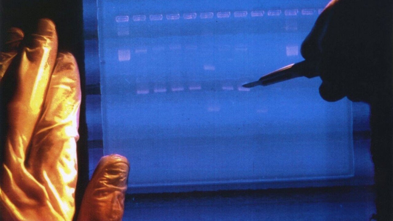 Vedcom sa podaril prelomový objav. Po prvýkrát rozlúštili celý ľudský genóm