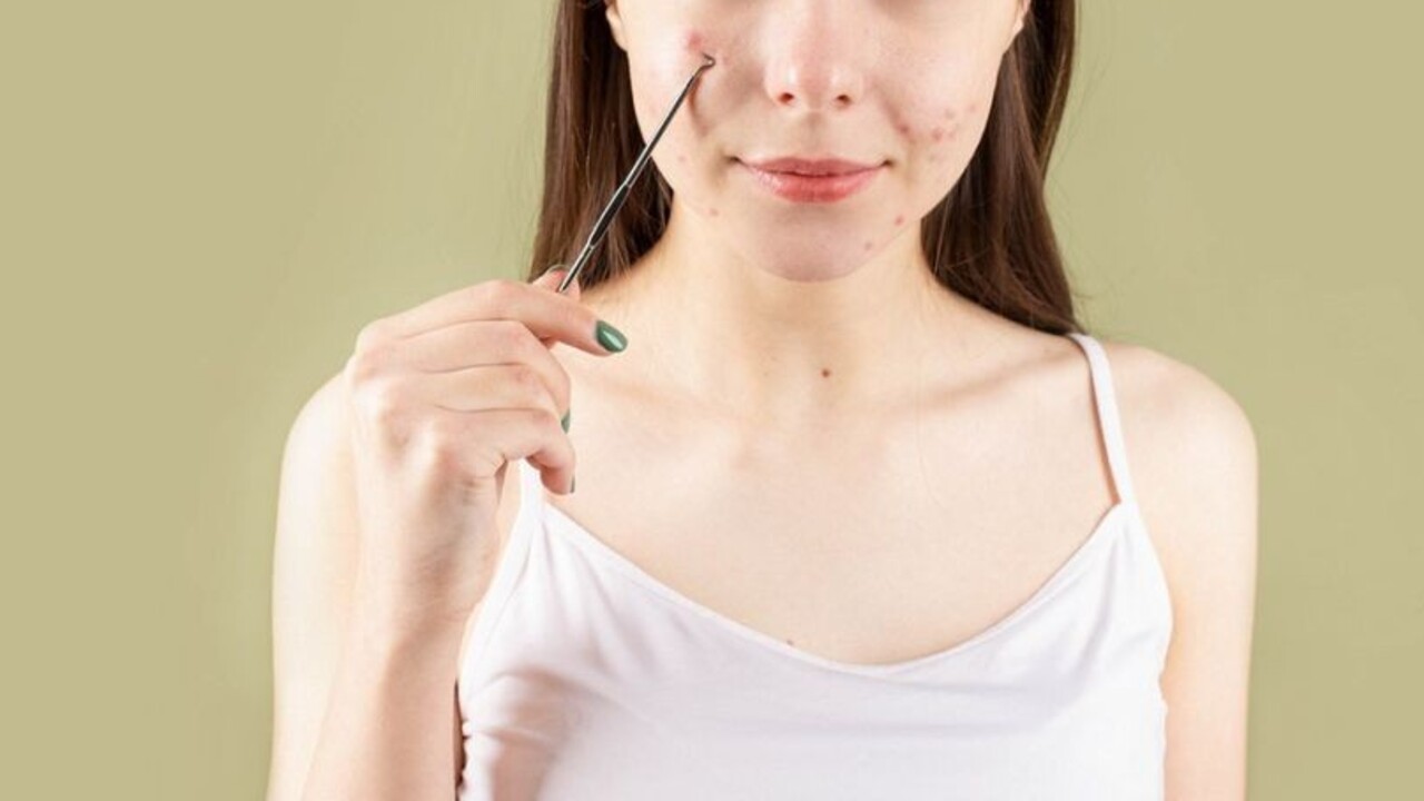 Jazvy po akné zničia zemiaky, med či uhorky. Aké ďalšie babské rady fungujú?