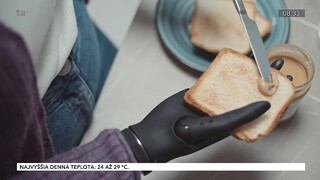 Najlepšia na trhu? Protetická ruka bude rozumieť vaším potrebám
