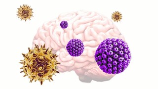 Pôsobenie dvojice bežných vírusov môže spustiť Alzheimerovu chorobu