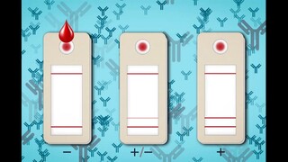 Vedci vyvinuli rýchly domáci test na meranie imunity voči ochoreniu COVID-19