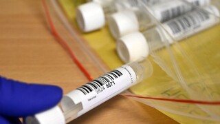 Testy odhalili stovky nakazených, covid si vyžiadal tri nové obete