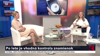 Na kontrolu znamienok by sme nemali zabúdať. Kedy je najvhodnejší čas zájsť k dermatológovi?