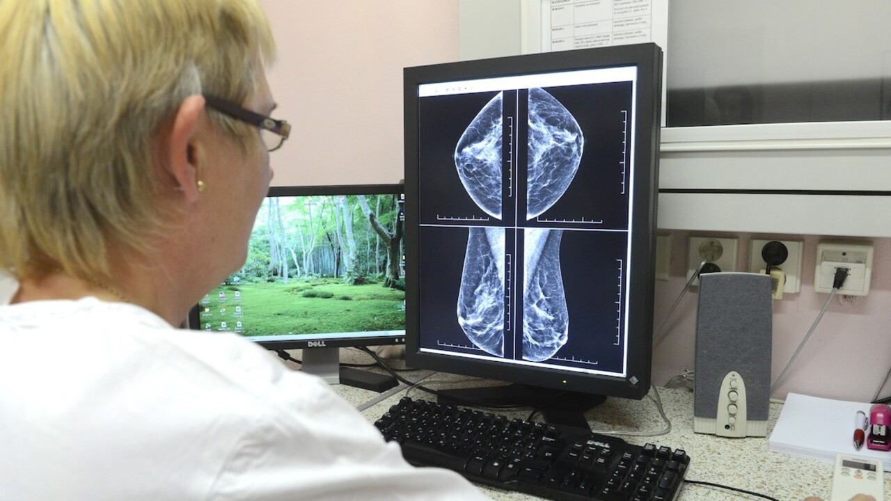 Nebojte sa zájsť k odborníkovi. Samovyšetrenie prsníkov i sonografia pomáhajú odhaliť rakovinu včas