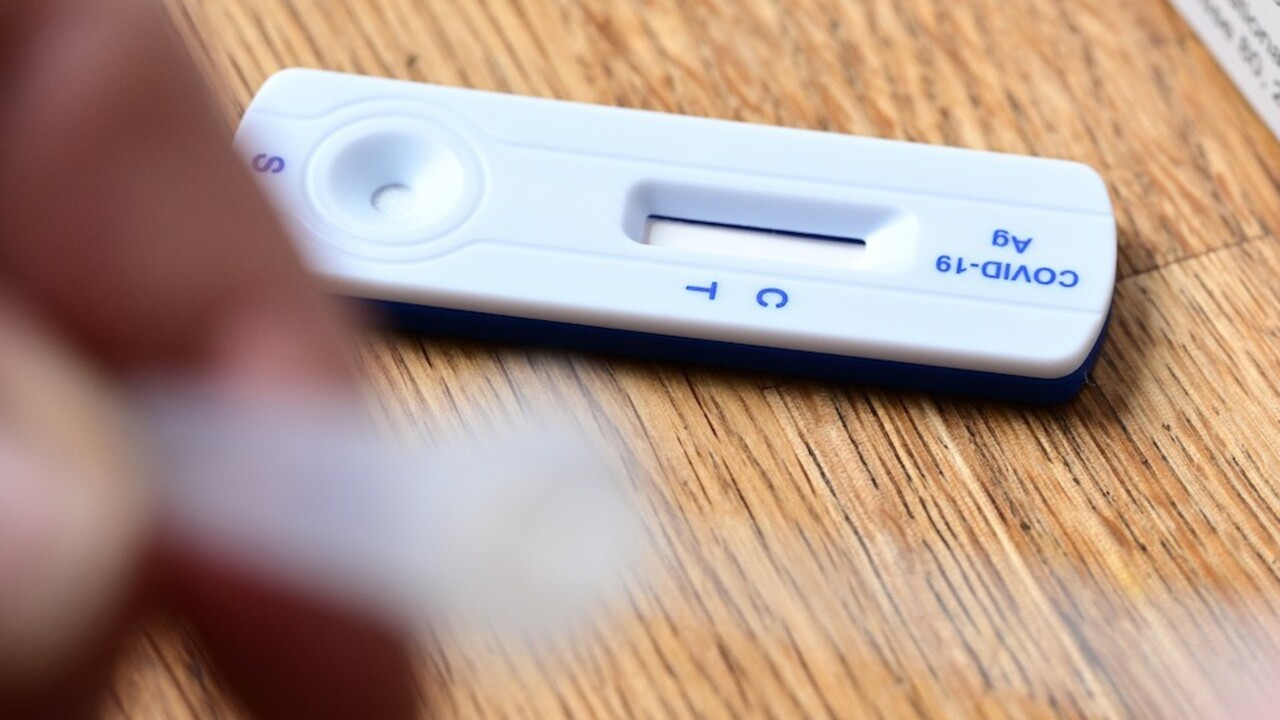 Na Slovensku pribudlo vyše 130 prípadov nákazy, covidu podľahli traja ľudia