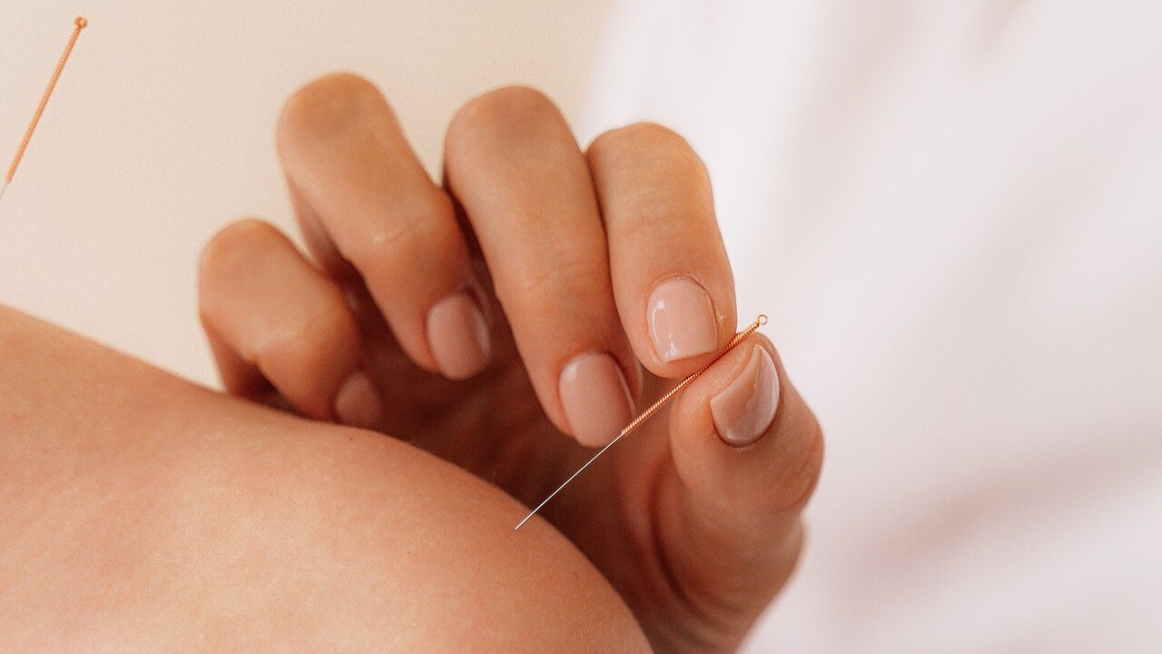 Akupunktúra je nový botox: Vyrieši vrásky, mdlú pleť aj kruhy pod očami