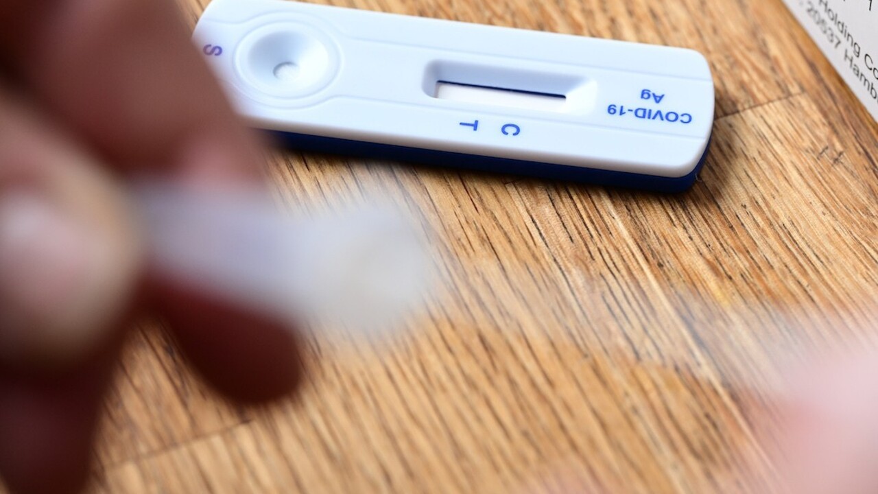 Covid máme pod kontrolou, lekári už neočakávajú preplnené nemocnice