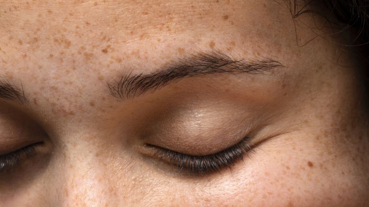 Zatočte s pigmentovými škvrnami: Stačí siahnuť do chladničky a zbavíte sa ich