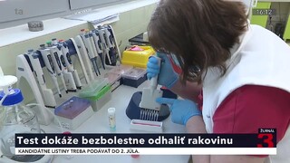 Významný pokrok slovenských vedcov. Krvný test dokáže bezbolestne diagnostikovať skorú rakovinu prostaty