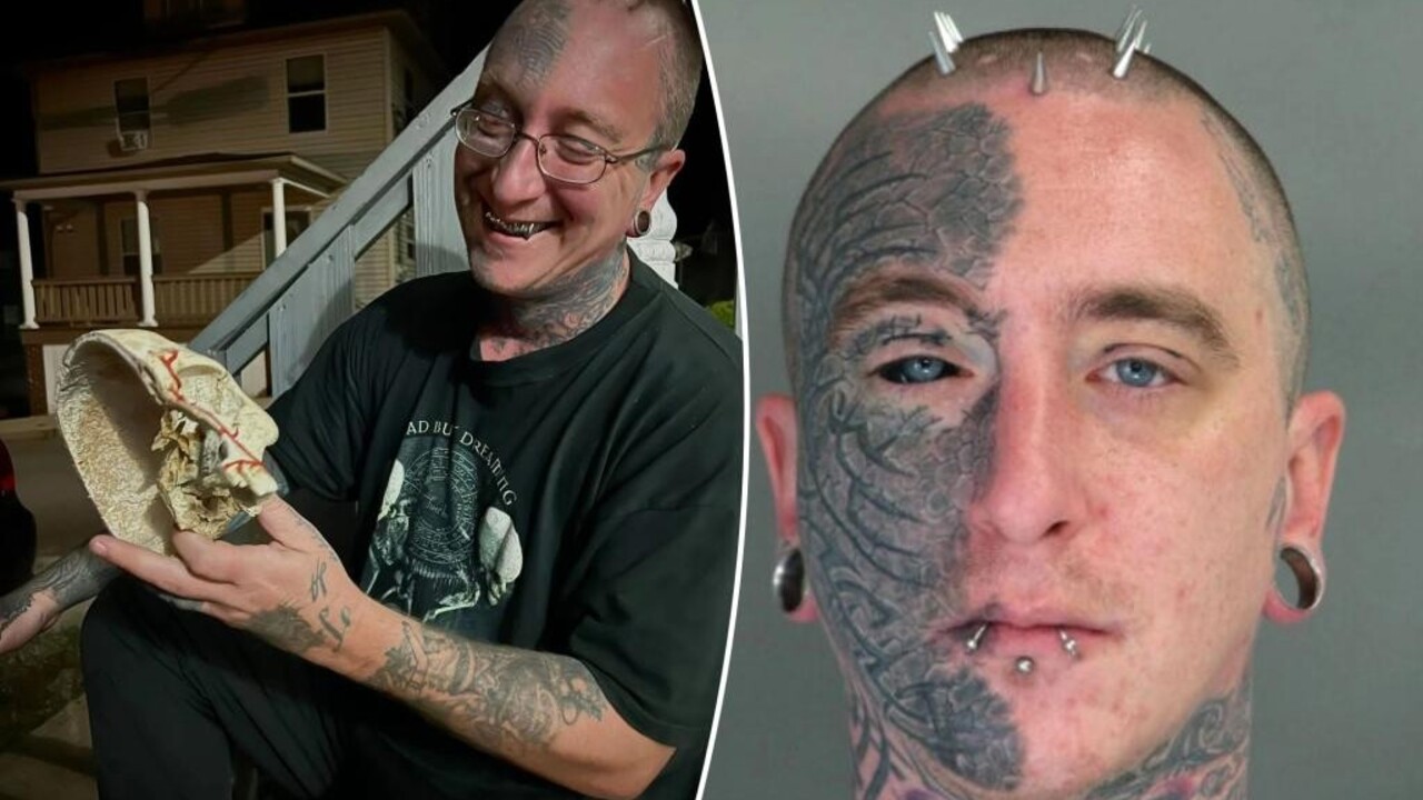 Predaj ľudských tiel na akademickej pôde. Správca márnice na Harvarde obchodoval s pozostatkami