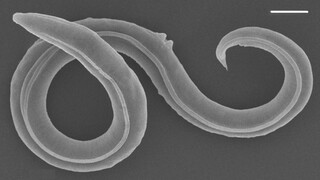 Sú nažive. Vedcom sa podarilo oživiť červy, ktoré boli zamrznuté 46-tisíc rokov