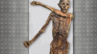 Plešina a veľmi tmavá pleť. Ľadový muž Ötzi vyzeral inak, ako sa predpokladalo