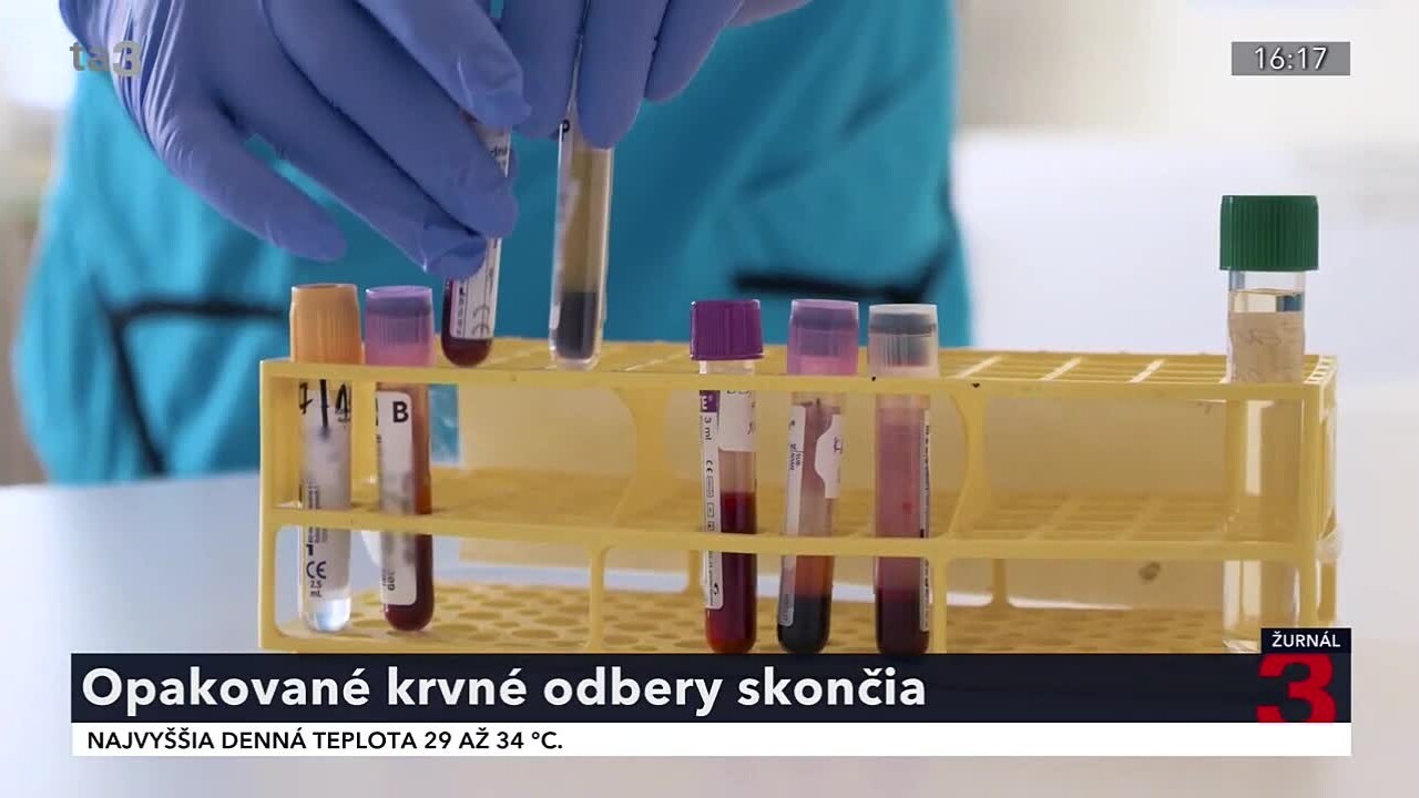 krv_1.jpg