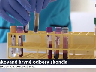 krv_1.jpg