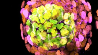 Vedci vytvorili modely podobné ľudským embryám z kmeňových buniek