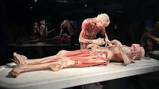 KDH odsudzuje výstavu ľudských tiel. Súčasťou sú zrejme aj telá väzňov, kritizuje hnutie