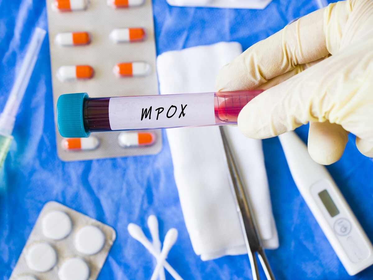 mpox