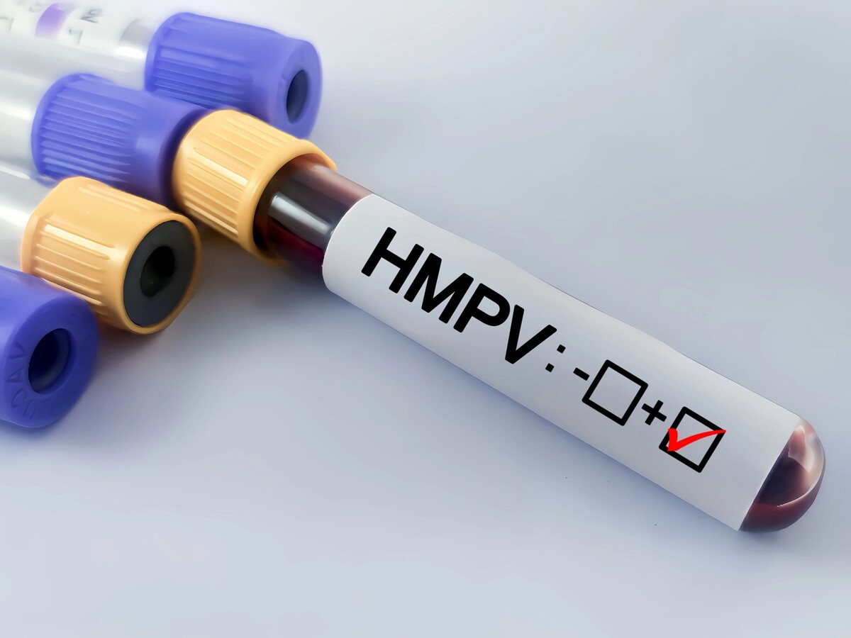 human metapneumovirus (HMPV)